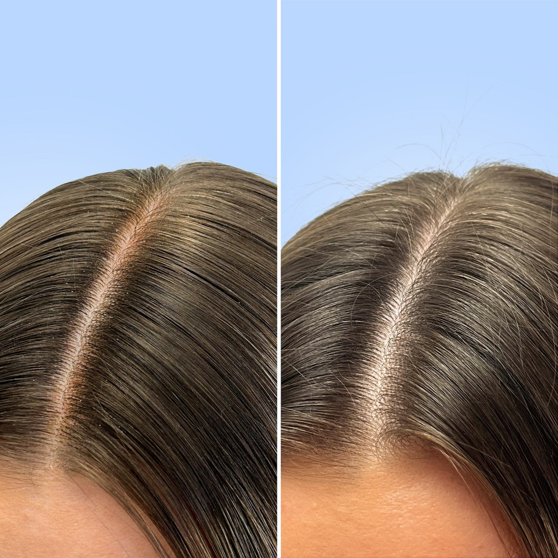 Clarifying Shampoo | Q+A
